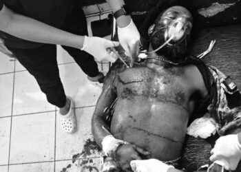 Ony Enumbi (27), who was fatally shot by members of the Damai Cartenz Task Force in Wiyugwi Village, Mulia District, Puncak Jaya Regency, Central Papua, on Monday (April 20, 2026) – Supplied