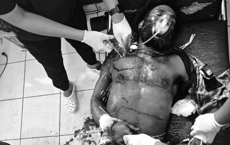 Ony Enumbi (27), who was fatally shot by members of the Damai Cartenz Task Force in Wiyugwi Village, Mulia District, Puncak Jaya Regency, Central Papua, on Monday (April 20, 2026) – Supplied