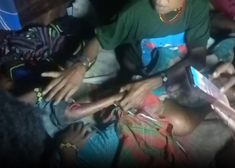 One of the children reported to have been injured by gunfire in Puncak Regency – Courtesy of Jubi